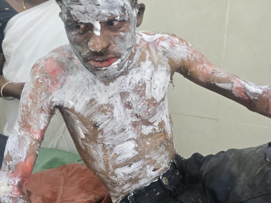 ஓசூரில் இளைஞர் தீக்குளித்து உயிரை மாய்த்துக்கொள்ள முயற்சி: பணிச்சுமை குறித்த புகார்; போலீசார் விசாரணை!